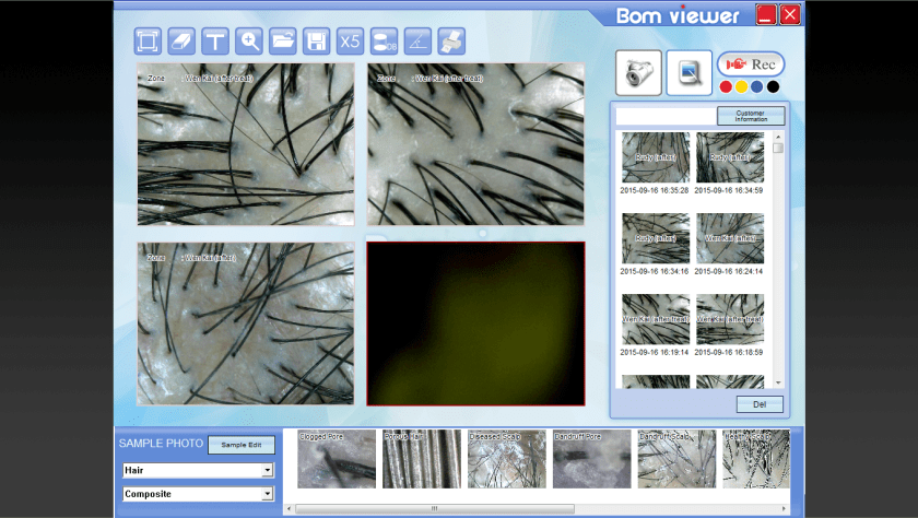 Definitely a substantial improvement. (Photo by: TK TrichoKare)